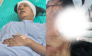 दिमाग माटी कहने पर महिला पर चाकू से…