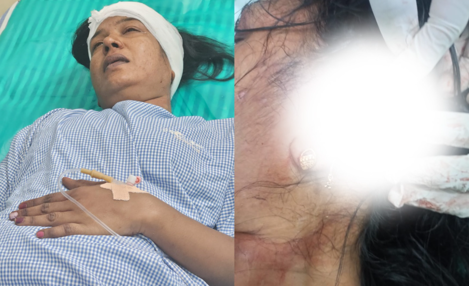दिमाग माटी कहने पर महिला पर चाकू से…